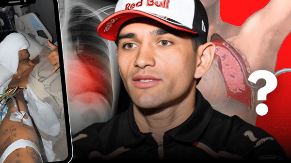 pneumothorax jorge martin